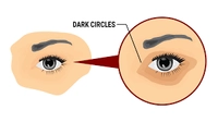 1656394907_2.png?f=webp&w=200