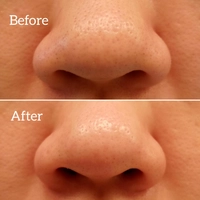 1657870791_1.jpg?f=webp&w=200