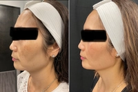 1688394848_1.jpg?f=webp&w=200