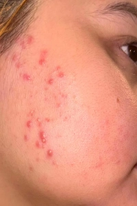 IMG_75842ad98662c688.jpeg?f=webp&w=200