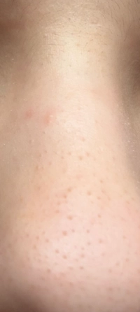 1765465081_IMG_3849566820af29e0.jpeg?f=w