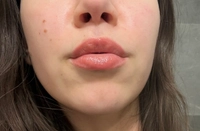 IMG_17147e8dd2a04a8a.jpeg?f=webp&w=200