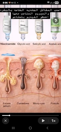 10005658764ee511f746e5.jpg?f=webp&w=200