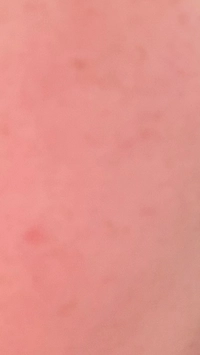 1773715479_IMG_493491c28e2728ca.jpeg?f=w