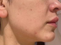 IMG_42131773333385387e0410ecc3fa9.jpeg?f