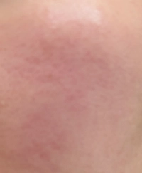 IMG_99059afb9a4b56f5.jpeg?f=webp&w=200