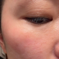 1775096152_IMG_1321127cfaa90631.jpeg?f=w