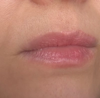 IMG_157318aaec1b7a28.jpeg?f=webp&w=200