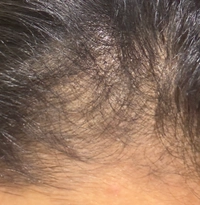 IMG_2635301a1c9f7972.jpeg?f=webp&w=200