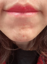 IMG_30813078938c0e63.jpeg?f=webp&w=200