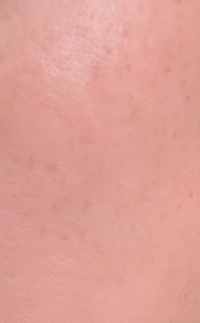 IMG_5237b9b193b8fdf3.jpeg?f=webp&w=200