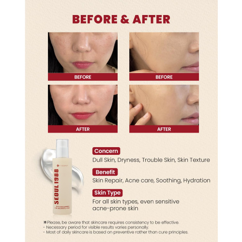 [KSECRET] SEOUL 1988 Essence : Snail Mucin 97% + Rice 100ml