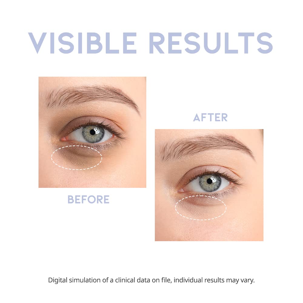 [OOTD Beauty] Intensive Eye Serum 30ml