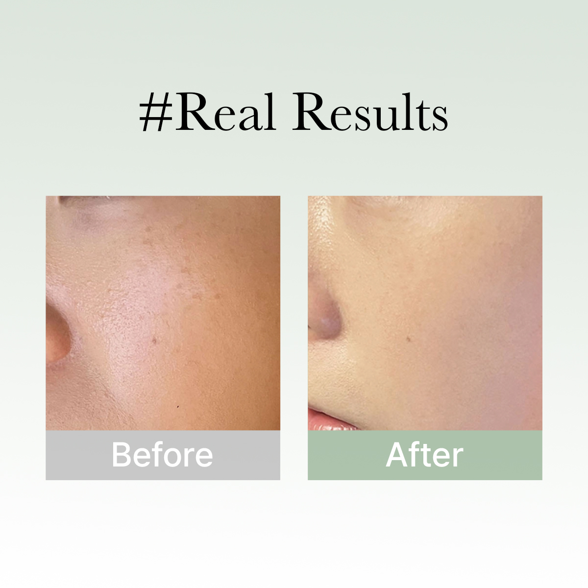 [ARENCIA]  Holy Hyssop Serum 30 50g