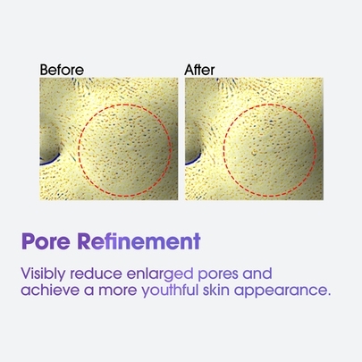 [SOME BY MI] ★1+1★  Крем для кожи вокруг глаз с ретинолом Retinol Intense Adavanced Triple Action Eye Cream 30мл