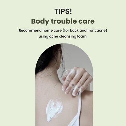 [Heimish] Нежная кремовая пенка для ухода за проблемной кожей Matcha Biome Amino Acne Cleansing Foam 150мл