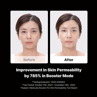 [MEDICUBE] Гаджет для домашнего ухода за кожей 6-в-1 AGE-R Booster Pro 1шт.