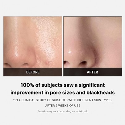 [MEDICUBE] Пэды для ухода за порами Zero Pore Pad 2.0 (70шт)