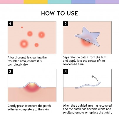 [OOTD] Патчи от акне Star Spot Patch (80 шт)