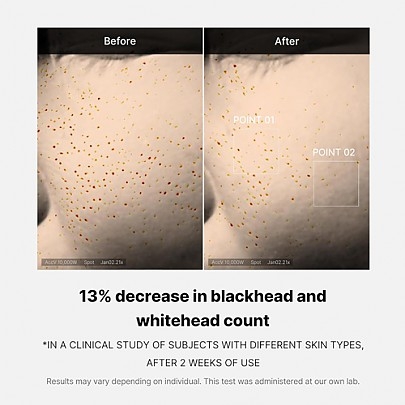 [MEDICUBE] Сыворотка для ухода за порами Zero Pore One Day Serum 30мл