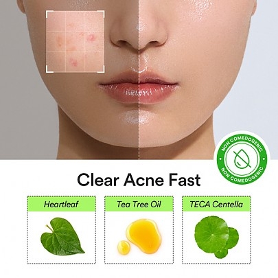 [Abib] Патчи от акне Heartleaf Calming Spot Patch 78шт