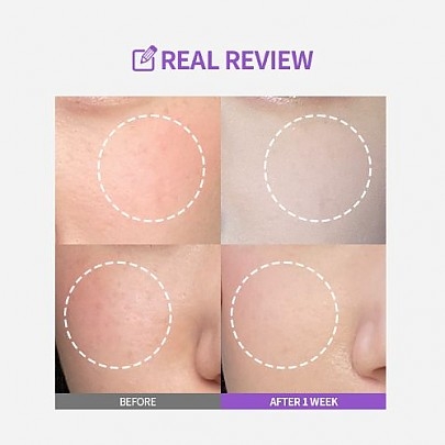 [SUNGBOON EDITOR] Ампула против пигментации Meoru Podo VitaC Dark Spot Ampoule 30мл