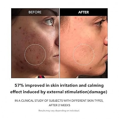 [APRILSKIN] Сыворотка для проблемной кожи Carrotene Clarifying Serum 37мл