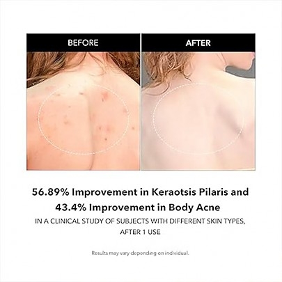 [APRILSKIN] Гель для душа для проблемной кожи Carrotene IPMP Exfoliating Body Wash 300мл