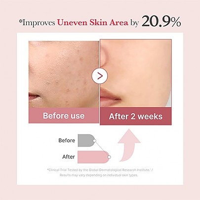 [MEDICUBE] Сыворотка с микроиглами и экзосомами PDRN Pink Exosome Shot Serum 2000 30мл