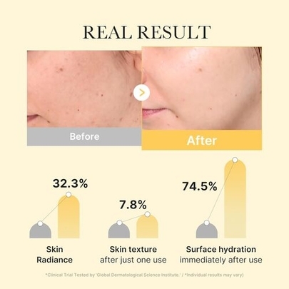 [MEDICUBE] Гидрогелевая маска с куркумой и койевой кислотой Kojic Acid Turmeric Gel Mask (4шт)