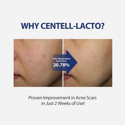 [SUNGBOON EDITOR] Эссенция для проблемной кожи Centell Lacto AC Less Skin Barrier Essence 30мл
