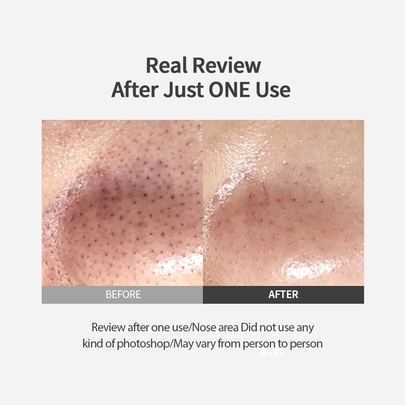 [SUNGBOON EDITOR] Пэды для удаления чёрных точек Blackhead Melting Clear Pad 65g (30шт)