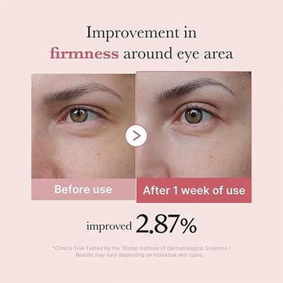[MEDICUBE] Крем для глаз PDRN Pink Eye Serum 30мл