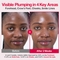 [Numbuzin] Сыворотка для лица с микроиглами No.2 Rose PDRN Collagen 2X Plumping Serum 30мл