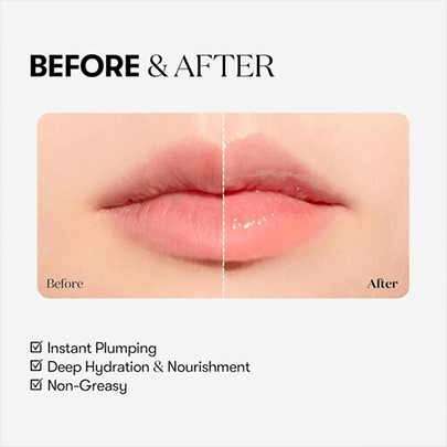 [VT Cosmetics] Плампер для губ (мягкое покалывание, начинающий уровень) Reedle Shot Lip Plumper Beginner