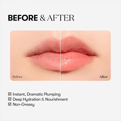 [VT Cosmetics] Плампер для губ (сильное покалывание, уровень эксперт) Reedle Shot Lip Plumper Expert