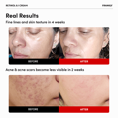 [FRANKLY] Крем с ретинолом Retinol 0.3% cream 20мл