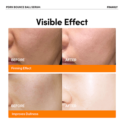 [FRANKLY] Капсульная сыворотка для упругости кожи PDRN Bounce Ball Serum 30мл