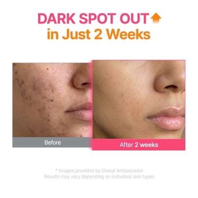 [Purito Seoul] Сыворотка с TXA, ниацинамидом и ретиналем TXA 6 Niacinamide 10 Retinal Serum (30 мл)