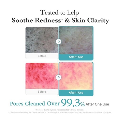 [MEDICUBE] Очищающая пенка с ниацинамидом Azelaic Acid Niacinamide Deep Clean Foam Cleanser 120мл
