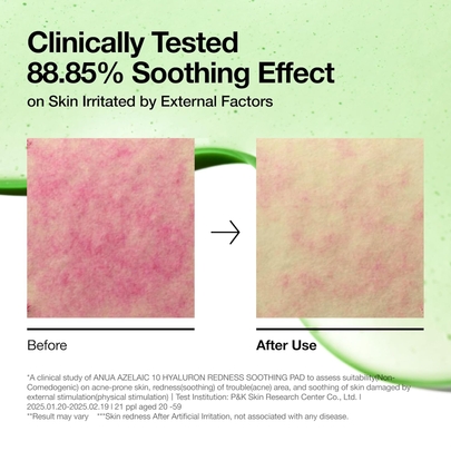 [Anua] Успокаивающие тонер-пэды Azelaic Acid 10 Hyaluron Redness Soothing Pad 90шт