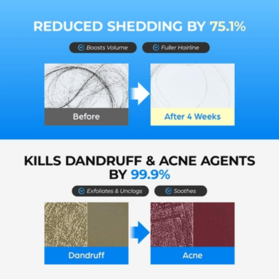 [Seapuri] *обновление* Освежающий баббл-тоник для кожи головы Scalpy Bubble Tonic 100мл