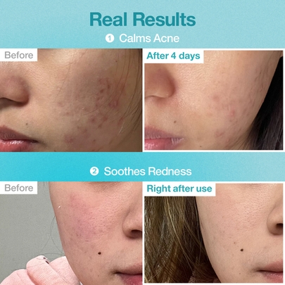 [Numbuzin] Маска No.1 Pantothenic B5 Hyaluronic Active Clear Mask (5шт)