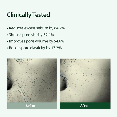 [Blithe] Targeted Pore Serum Niacinamide 22 30 мл