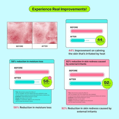[EDIT.B]Гелевая эссенция Calming Tok Cica Heartleaf, 200 мл