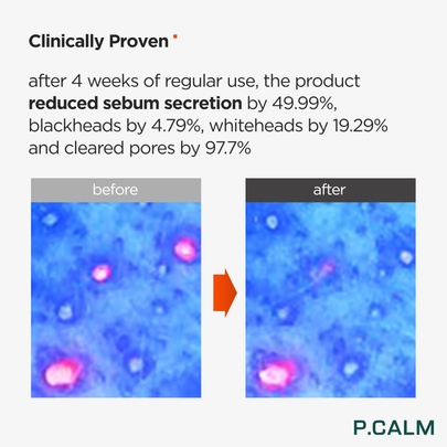 [P.CALM] *mini* Пенка для умывания Under Foam Cleanser 12мл