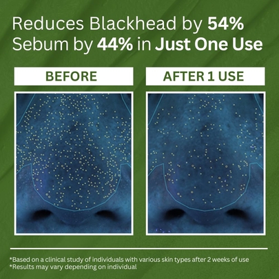 [P.CALM] Глубоко очищающая пузырьковая маска Holy Basil Bubble Deep Mask 90мл