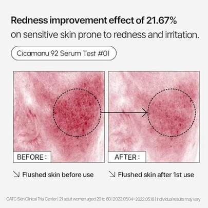 [PARNELL] *renewal* Сыворотка Cicamanu 92 Serum 30мл