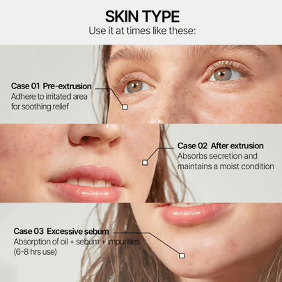 [PARNELL] *renewal* Патчи Cicamanu Clear Patch (48шт)