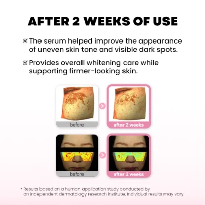 [PRO-CALM] Осветляющая лифтинг-сыворотка Mela Whitening Lifting Serum 20мл